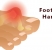 Plantar Fasciitis,Pes Planus,Mallet Toe,High Arched Feet,Heel Spur,Heel Pain,Hammer Toe,Hallux Valgus,Foot Pain,Foot Hard Skin,Foot Conditions,Foot Callous,Flat Feet,Fallen Arches,Diabetic Foot,Contracted Toe,Claw Toe,Bunions Hard Skin,Bunions Callous,Bunion Pain,Ball Of Foot Pain,Back Pain