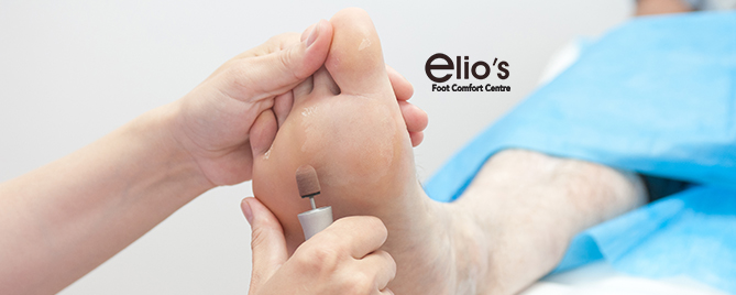 Diabetic feet assessment Elio's foot comfort centre