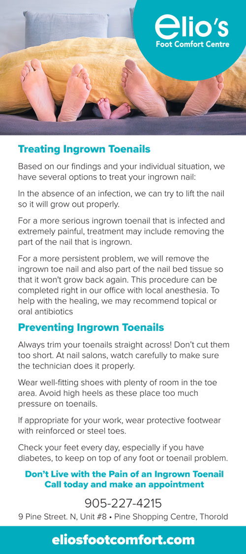 How To Prevent Ingrown Toenails And How To Best Treat Ingrown Toenails