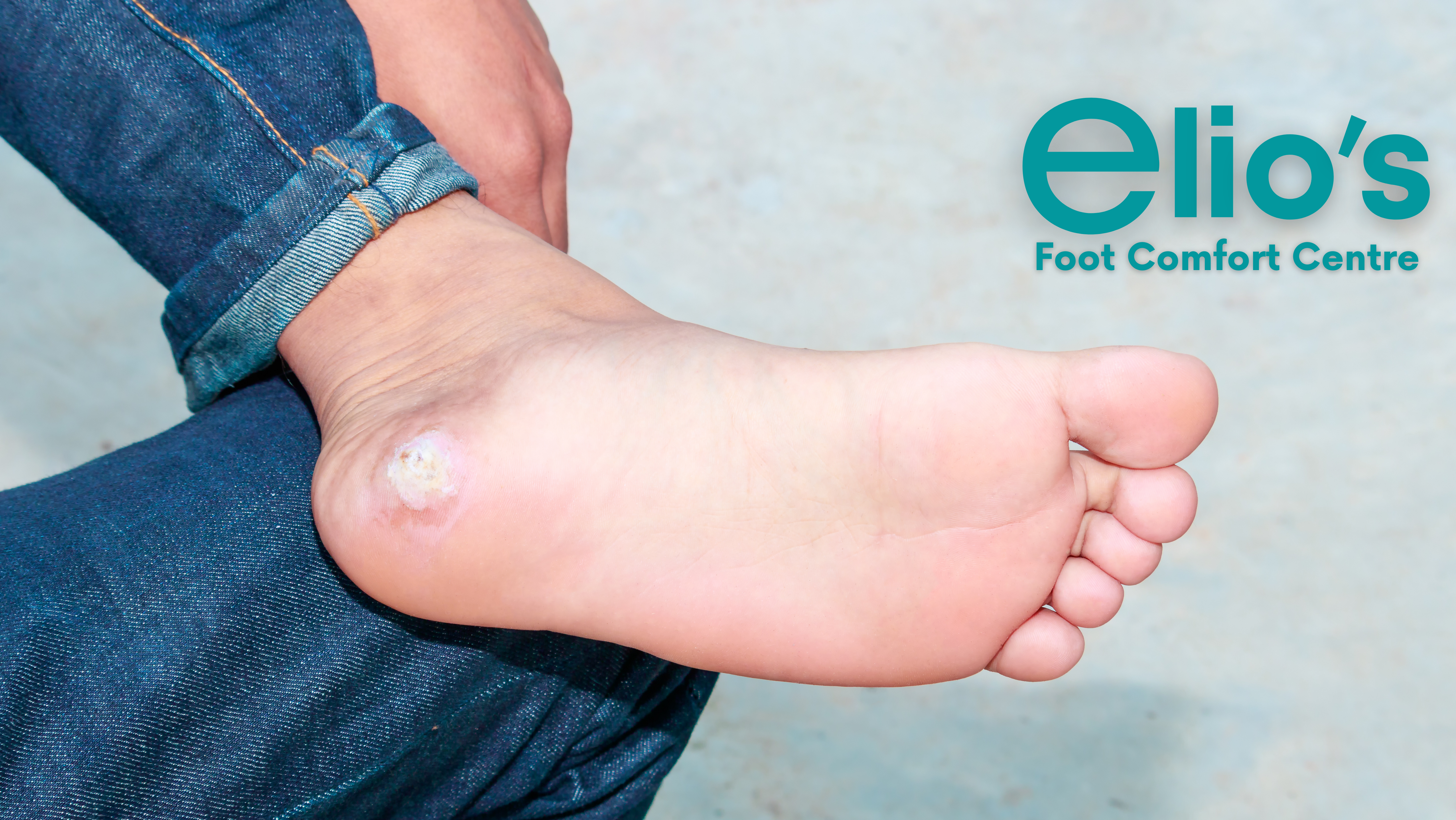 foot assessment Elio's Foot Comfort Centre