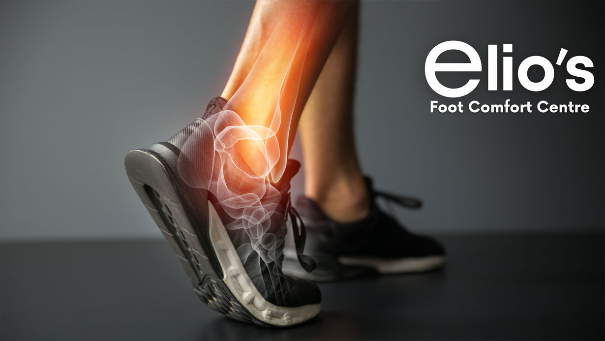 Learn about Arthritis provided by Elio's Foot Comfort Centre